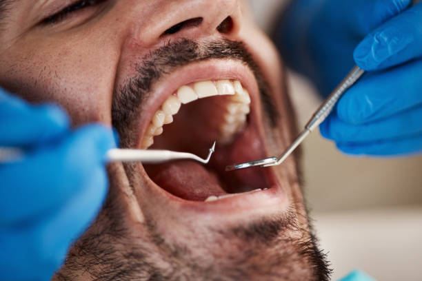 Best Emergency Broken Tooth Repair in Falfurrias, TX